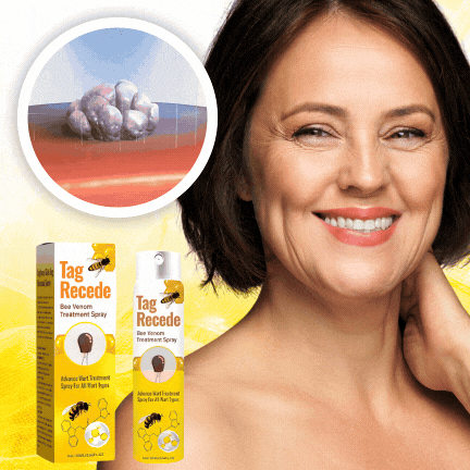 Liora Leven™ BeeSmooth Spray – Vlekkeloze, Knobbelvrije Huid in 7 Dagen!