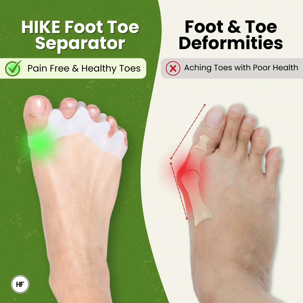 HIKE Foot Toe Separator – For Daily Comfort, Soft Toe Support & Suitable for Bunions and Hammer Toes